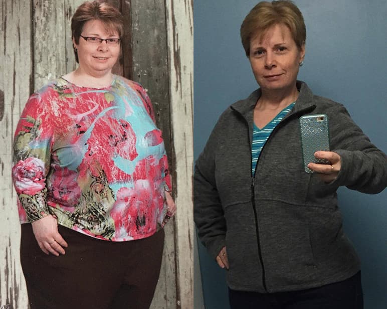 Woman's weight loss transformation before and after.