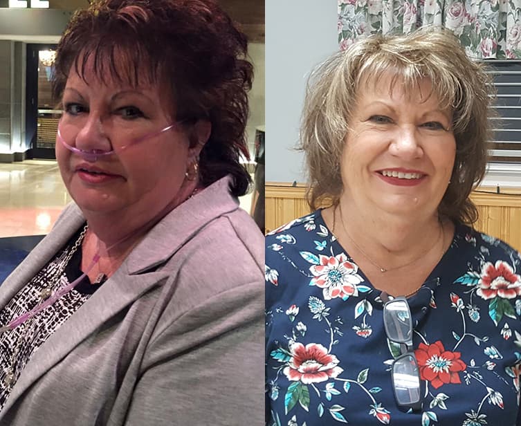 Two photos of the same smiling woman.