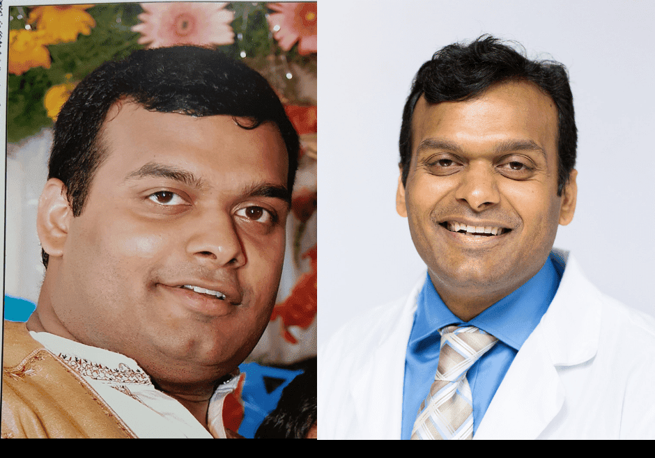 My-before-and-after